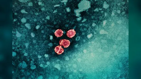 Colorized transmission electron micrograph showing many small round hepatitis B virus particles in pink